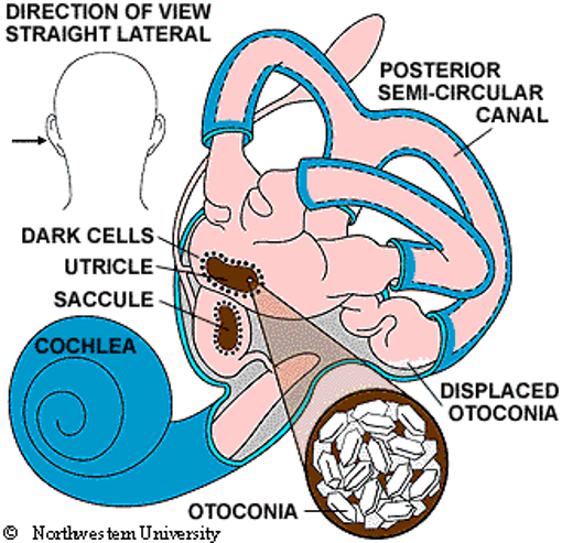 Dizziness – Could it be caused by a condition treatable with physiotherapy called BPPV?